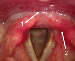 Larynx open