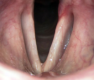 Normal vocal folds open