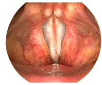 The larynx - closed