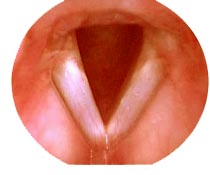 The larynx - open